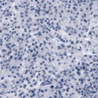Monoclonal Anti-SLCO1B3 antibody produced in mouse 