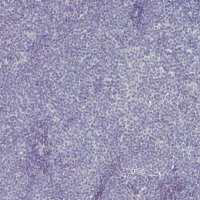 Monoclonal Anti-SOX11 antibody produced in mouse 