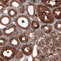 Monoclonal Anti-ST13 antibody produced in mouse 