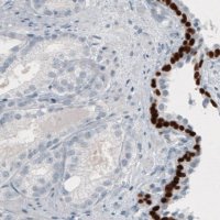 Monoclonal Anti-TP63 antibody produced in mouse 