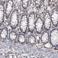 Monoclonal Anti-VSIR antibody produced in mouse 