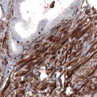 Monoclonal Anti-ZYX antibody produced in mouse 