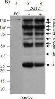 Anti-Human Kappa Light Chains (Bound and Free)Peroxidase antibody produced in goat 