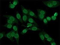 Anti-Human Polyvalent Immunoglobulins (whole molecule)FITC antibody produced in rabbit 