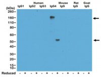 Rabbit-Anti-Human IgG4 Antibody, clone RM120 4-1667
