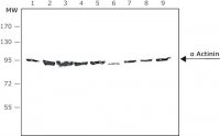 Anti- Actinin antibody, Mouse monoclonal 