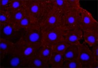 Anti--Actin antibody, Mouse monoclonal 