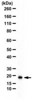 Anti-60S Ribosomal Protein L26 