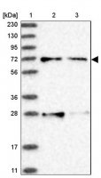 Anti-ACOX3 antibody produced in rabbit 