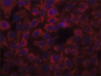 Anti-Actin (-Sarcomeric) antibody, Mouse monoclonal 