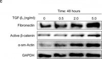 Anti-Active--Catenin (Anti-ABC) Antibody, clone 8E7 