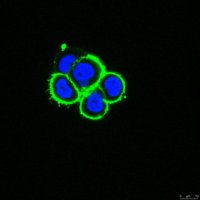 Anti-ADAM 12 Antibody, clone 6E6 