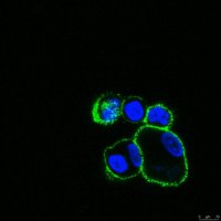 Anti-ADAM 12 Antibody, clone 8F8 