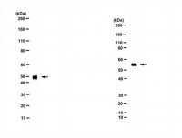 Anti-Alpha-2-HS-Glycoprotein 