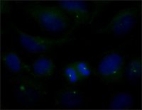 Anti-AMSH/STAMBP antibody produced in rabbit 