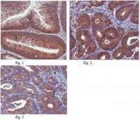 Anti-Beclin-1 Antibody, clone 9A1.1 