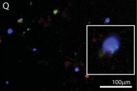 Anti-Brain lipid binding protein Antibody 