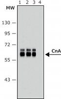 Anti-Calcineurin (-Subunit) antibody, Mouse monoclonal 