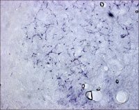 Anti-Calcitonin Gene Related Peptide antibody produced in rabbit 