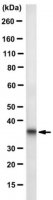 Anti-Calponin Antibody, clone CALP 