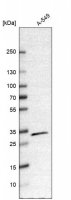 Anti-CBR1 antibody produced in rabbit 