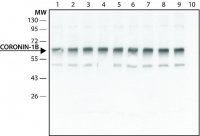 Anti-Coronin 1B antibody produced in rabbit 