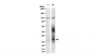 Anti-CRB3A Antibody, clone 1E6 