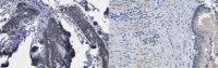 Anti-CXCR-4 