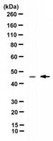 Anti-Cytokeratin 19 Antibody, clone TROMA-3 