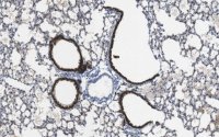 Anti-Cytokeratin 8 Antibody, clone TROMA-1 