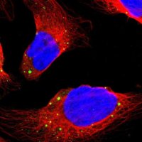 Anti-DCP1A antibody produced in rabbit 