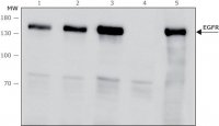 Anti-Epidermal Growth Factor (EGF) Receptor antibody, Mouse monoclonal 