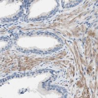 Anti-FDFT1 antibody produced in rabbit 