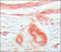 Anti-Fibroblast Growth Factor Receptor-1 antibody produced in rabbit 