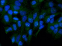 Anti-FKHRL1 (FOXO3a) antibody produced in rabbit 