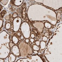 Anti-GCLM antibody produced in rabbit 