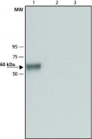 Anti-Glucocerebrosidase (C-terminal) antibody produced in rabbit 