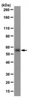 Anti-GLUT1 (CT) Antibody, clone 5B12.3 