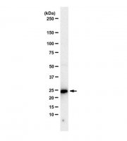 Anti-Glutathione S-transferase A5 (GSTA5) 