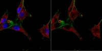 Anti-Glypican-1 
