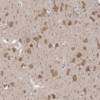 Anti-GSK3B antibody produced in rabbit 