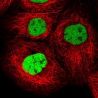 Anti-GTF2I antibody produced in rabbit 