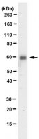 Anti-Heparanase-1 