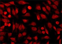 Anti-Histone Deacetylase 1 (HDAC1) antibody produced in rabbit 