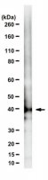 Anti-HSD3B2 Antibody, clone 6 