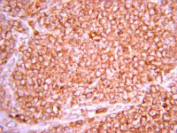 Anti-Hypoxia Inducible Factor 1 Antibody, clone H167 