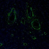 Anti-ITPKA antibody produced in rabbit 