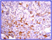 Anti-JAK2 Antibody, clone 8E10.2 