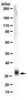 Anti-Ketohexokinase Isoform C Antibody, clone 5F1-3F5 