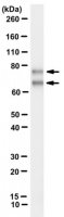 Anti-Lamin A/C Antibody, clone 2A1 
